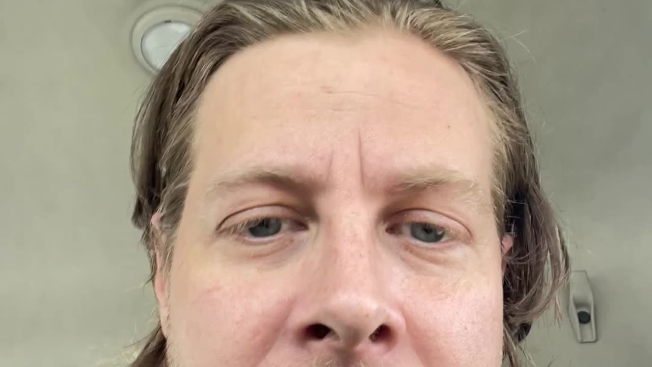 Comney obstruction , Candace Owen’s , Canada Organs