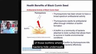 Dr.SHIVA™: Black Cumin on Immune Health @CytoSolve® Systems Analysis(8/20)