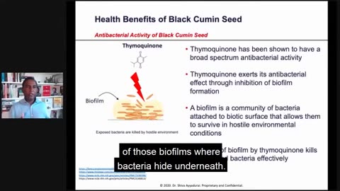 Dr.SHIVA™: Black Cumin on Immune Health @CytoSolve® Systems Analysis(8/20)