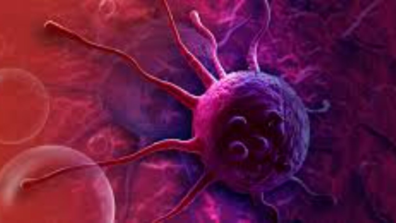 Dr William Makis Questions and Answers Covid, Vaccines, Turbo Cancers, Repurposed Drugs