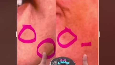 The Elvis Twins - Fittest Flat Earther