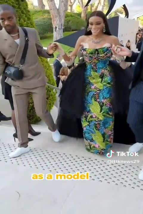 4 celebrities who were born with rare condition