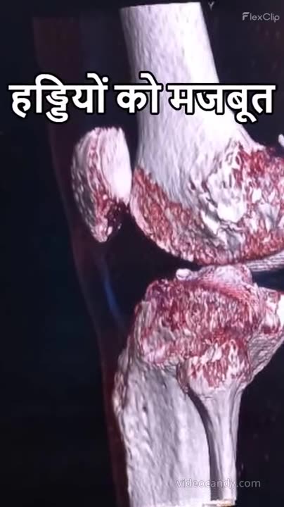 Gobhee Sirph Sabjee Nahin, Ek Khajaana