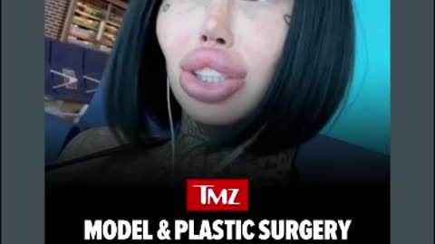 Rip to mary magdalene surgery influencer rip to her 🙏🕊🕯⚰️🪦12/22/25