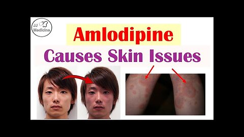 These 4 Skin Disorders Can Be Caused By Amlodipine (Most You've Probably Never Heard Of)