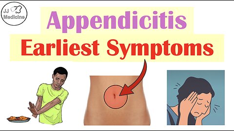 Earliest Symptoms of Appendicitis (Before It Ruptures)