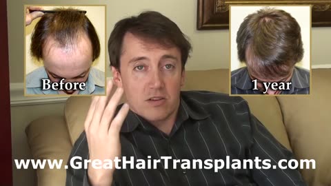 Dr. Brett Bolton | Unbelievable Hair Transplant Result Correcting a Birth Defect