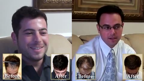 Budget-Friendly Hair Transplant in Aventura, Florida – Promo