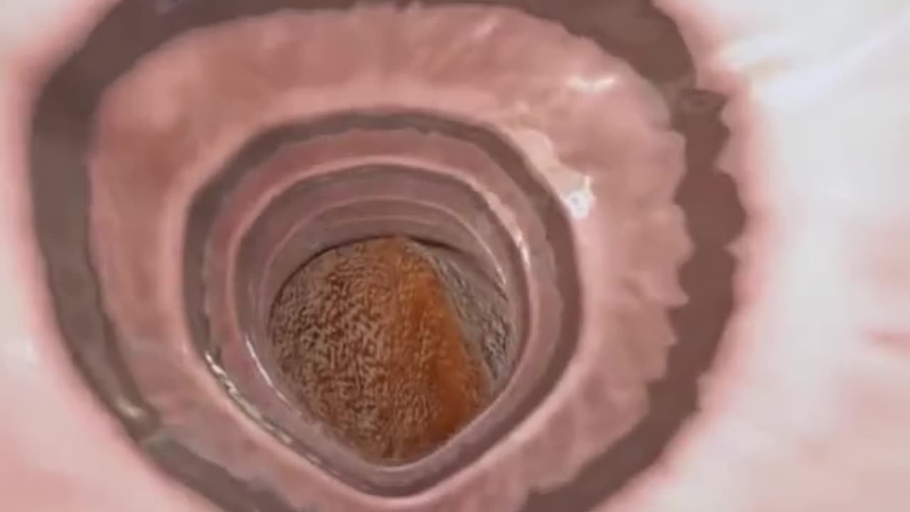 How Food Turns Into Poop Working Of Human Digestive System (3D Animation)