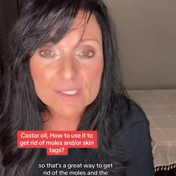 How to get rid of skintags, moles and warts naturally