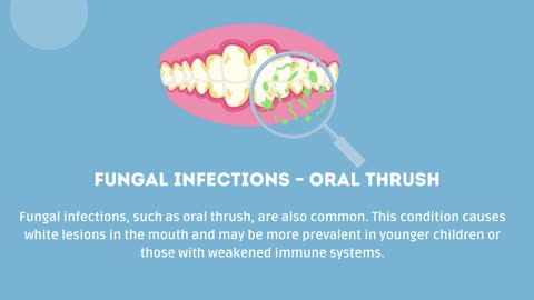 Common Causes of Oral Lesions in Children