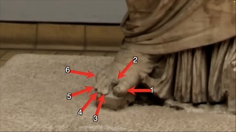 Removing the 6-Fingered Hands and Feet