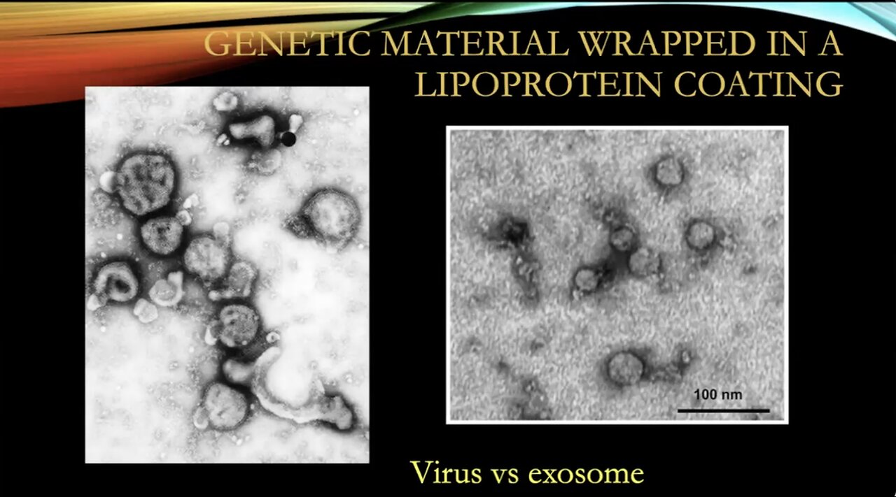 The Flying Unicorn--Part 4 Electron microscopy vs Light Microscopy and the Viral Theory