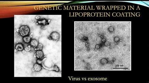 The Flying Unicorn--Part 4 Electron microscopy vs Light Microscopy and the Viral Theory