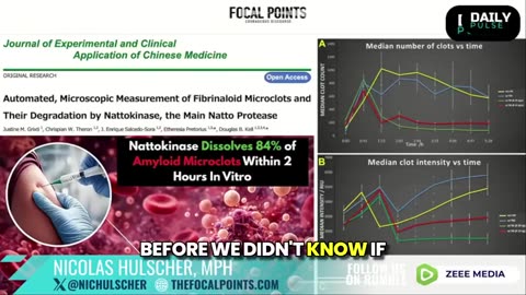 Nattokinase can break down 84% of amyloid microclots