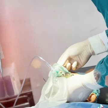 his boss shoved an air hose up his rectum