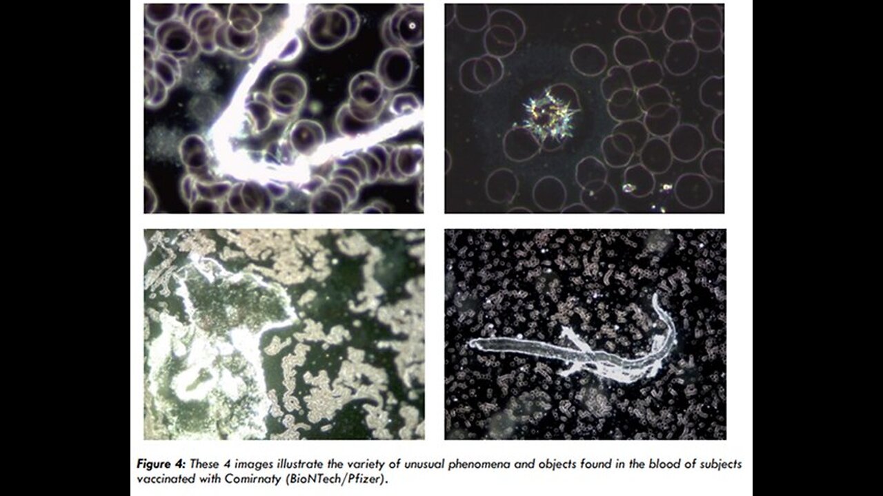 Szokujące badanie dowodzi, że zanieczyszczenie DNA w szczepionkach mRNA na COVID jest 100 razy gorsze, niż wynika z testów.