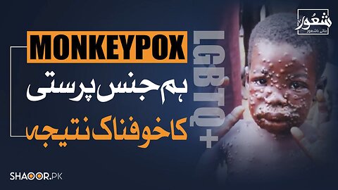 Monkeypox in Pakistan & LGBTQ