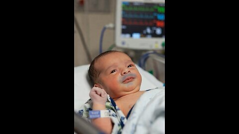 Infant in hospital with cyanosis