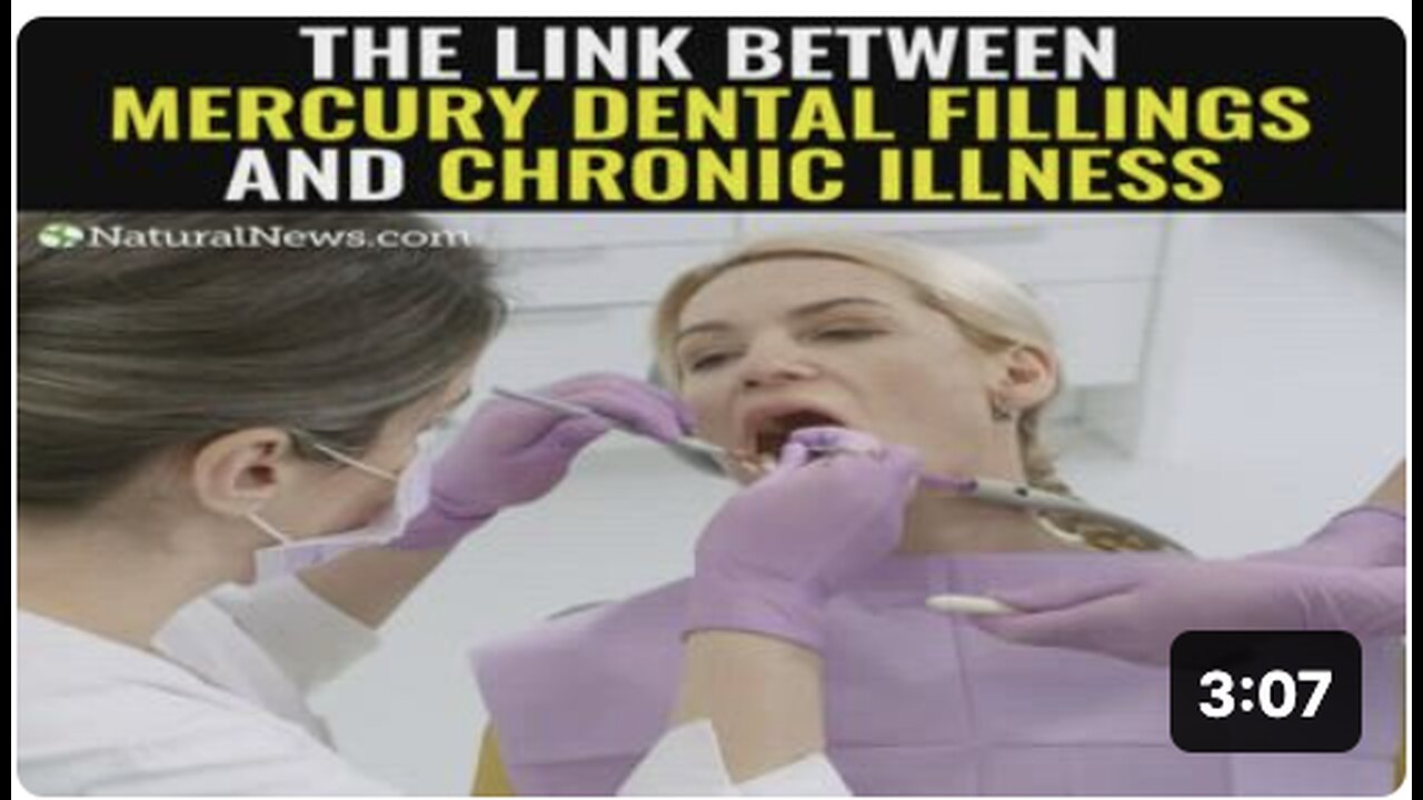 The link between mercury dental fillings and chronic illness