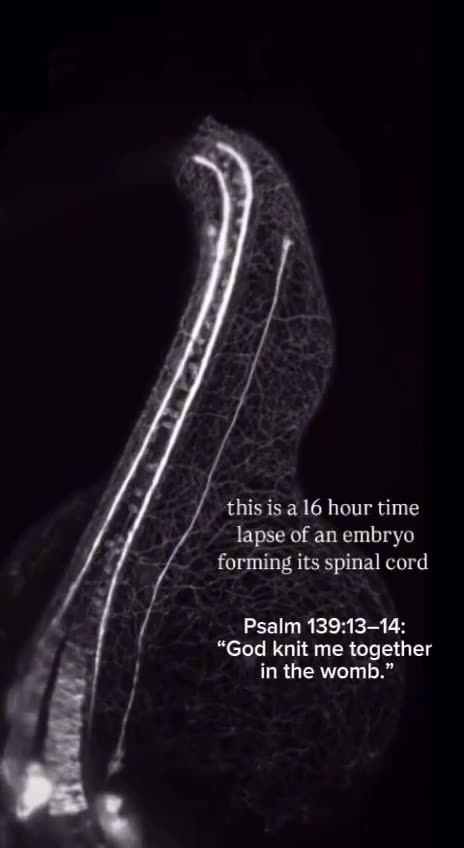 For thou hast possessed my reins: thou hast covered me in my mother’s womb. I will praise thee; for I am fearfully and wonderfully made: marvellous are thy works; and that my soul knoweth right well. Psalm 139:13-14