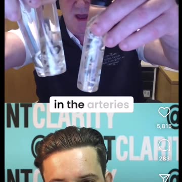 White calamari in the veins.