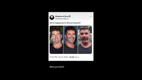 What happened to Simon Cowell?