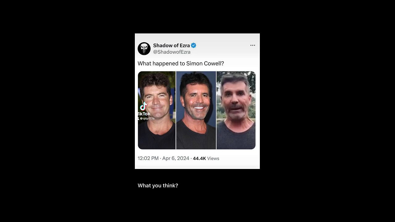 What happened to Simon Cowell?