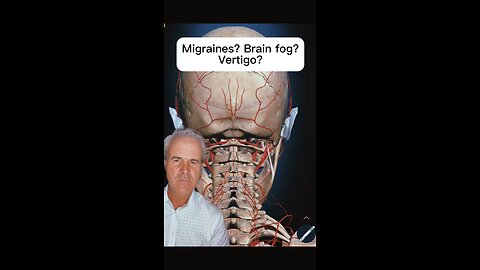 Why your migraine me be caused in your neck not your brain | Natural healing doctor | Neckwise