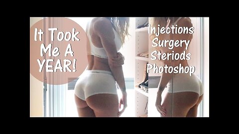 Took Me A Year Injections, Surgery, Steroids & Photoshop False Hope In The Fitness Industry