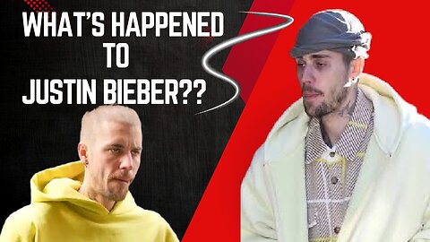 What's happened to Justin Bieber?