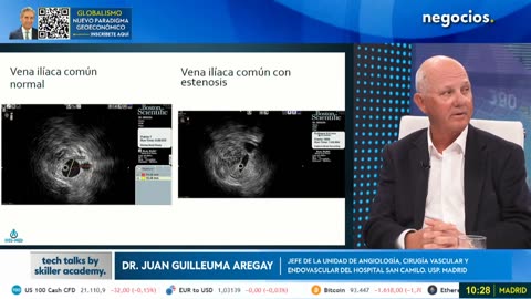 ¿Cómo se entiende la tecnología del dinero? "La IA está marcando nuestro ritmo" | TECH TALKS