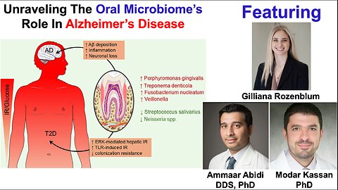 Unraveling The Oral Microbiome’s Role In Alzheimer’s Disease