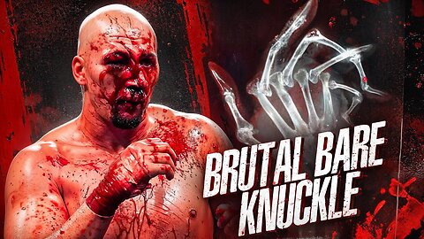 You_ll Wish You Didn_t Click 😳(