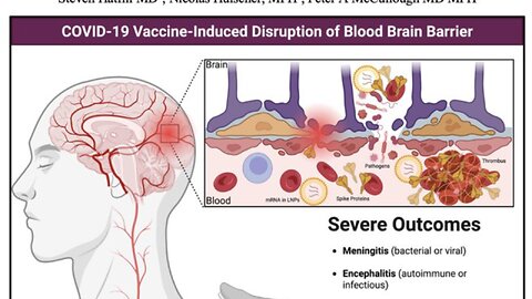 Cool Australians? Needle linked to messed up minds