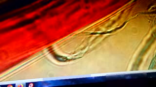 Time Release Death Injections 1/28/26: