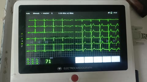 ECG report: what you think about it