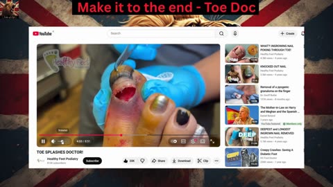 Make it to the end - Toe Doc