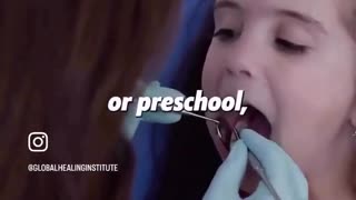 The Power of Iodine To Treat Cavities