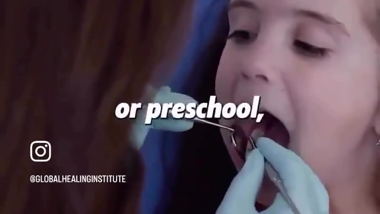 The Power of Iodine To Treat Cavities