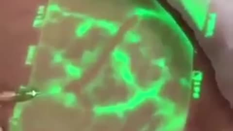 🧠👀 Watch This Vein Viewer Help Doctors See Veins! | FeedMyCuriosity