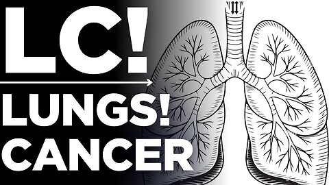Lung Cancer: Myths Busted & Facts You Need to Know | Medickpidia