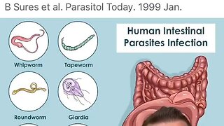 Parasite heavy metal rabbit hole: Clean up the heavy metals and the body heals