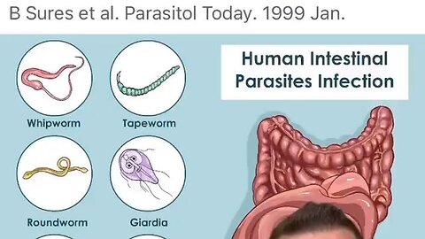 Parasite heavy metal rabbit hole: Clean up the heavy metals and the body heals