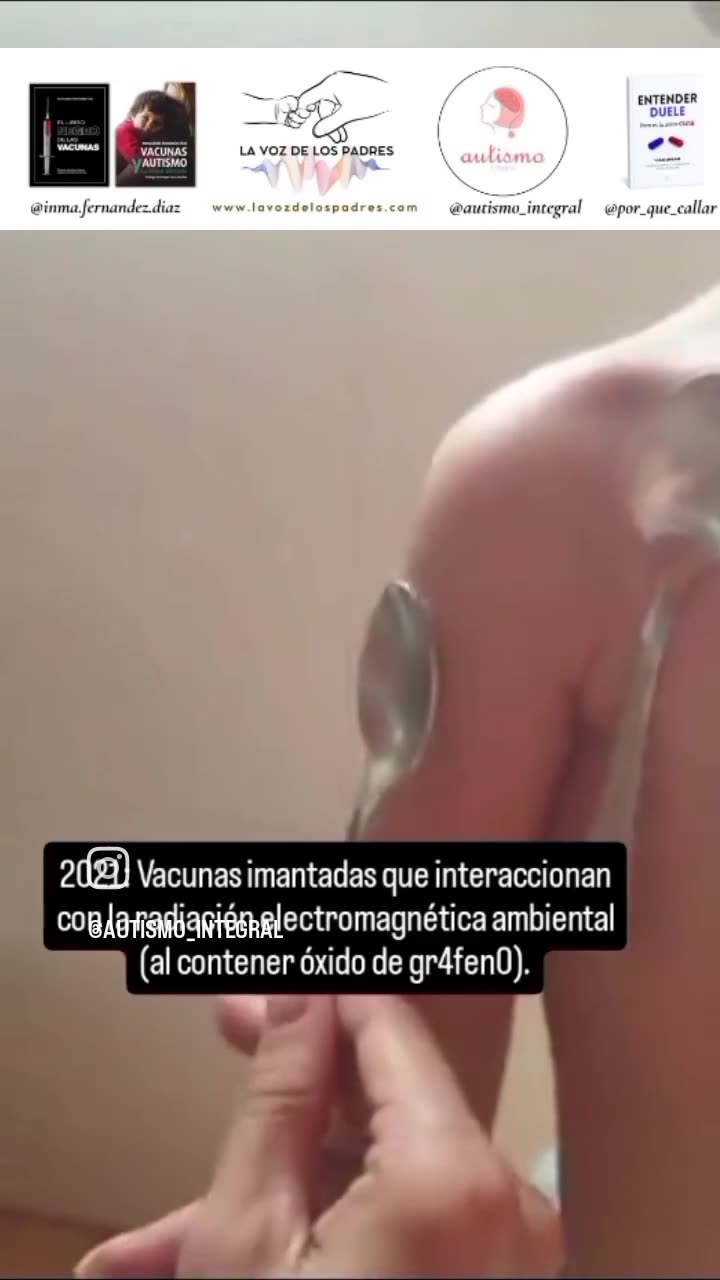 El SUDOR 😢💉📡🔬🧲💀 niños MAGENETICOS