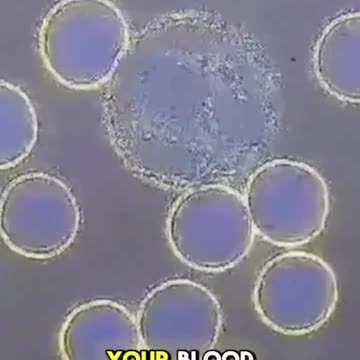 Vaccinated blood before & after detox is both fascinating & scary