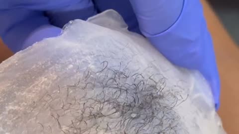 Underarm Waxing with Sexy Smooth Coconut Pearl Essence Hard Wax by @theskynsanctuary