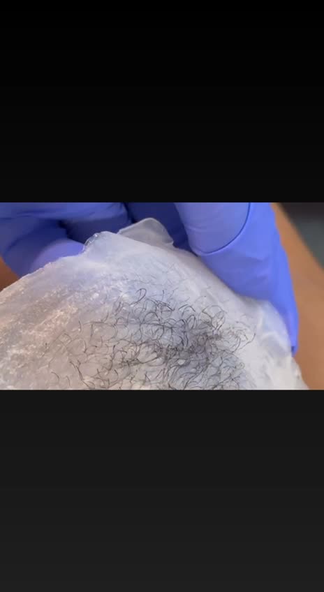 Underarm Waxing with Sexy Smooth Coconut Pearl Essence Hard Wax by @theskynsanctuary