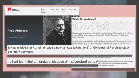 Fact Check: Alzheimer's Disease Did NOT First Appear In 1979 -- And Margarine Not To Blame