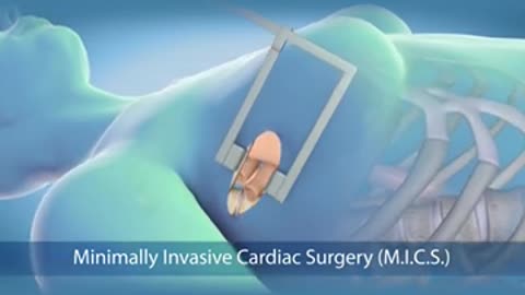 Venous Leak Treatment